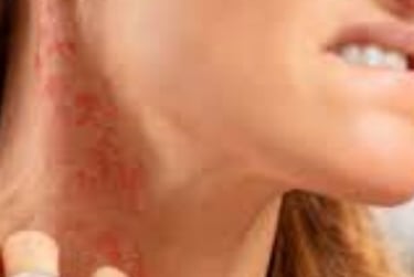 Fasting For Skin Allergies Itching & Pruritus