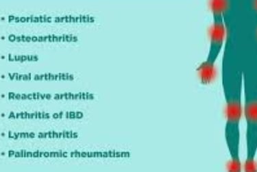 Stages of Rheumatoid Arthritis