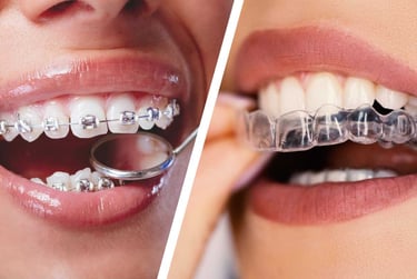 comparison between aligners and metal braces for teeth alignment in Mumbai