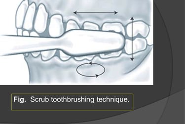 Scrub technique of brushing