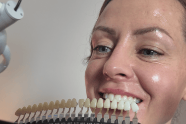 GloSmilz teeth whitening analysis