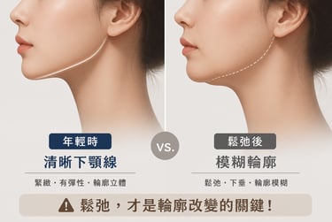 下顎線變化示意圖 左邊:年輕時清晰下顎線 右邊:鬆弛後模糊輪廓