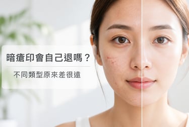 暗瘡紅印與黑印對比示意圖 不同類型暗瘡印的淡化時間差異