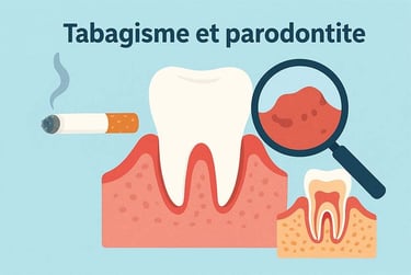 Tabagisme et parodontite hygiene-precision.com