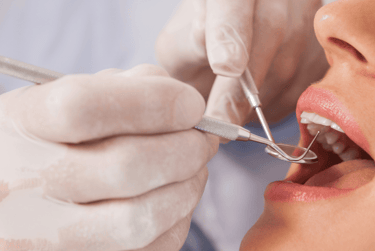 clear braces consultation