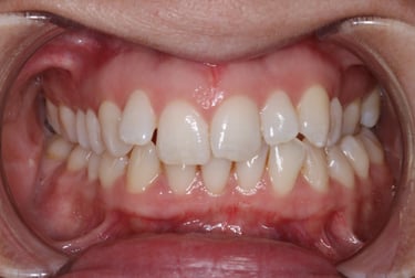 pictures of teeth