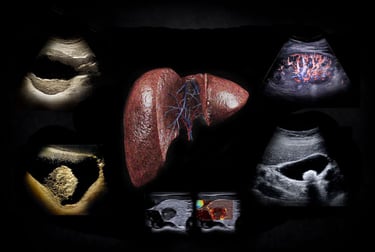 Medical illustration of a human liver surrounded by diagnostic ultrasound and doppler imaging scans.