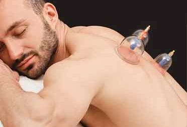 Male relaxed and happy receiving cupping on his back