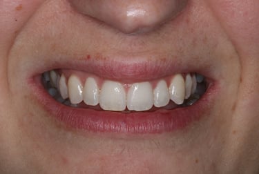 pictures of teeth