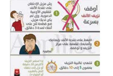 اوقف النزفكيف تدير نزيف الانف :علاج نزيف الانف الخلفي بالعسل والمضمضة
