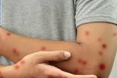 A warning sign of diabetes  (5)