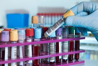 Human serum samples