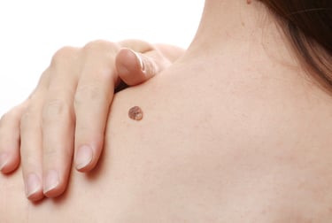 Expert assessment of moles and skin lesions and skin cancer diagnosis and treatment.