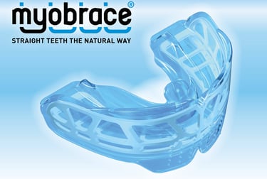Myobraces or Trainers