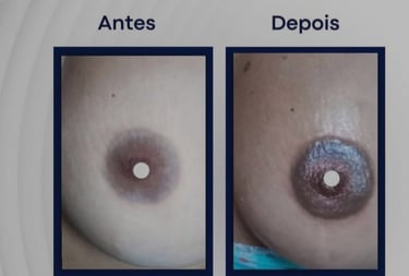 Camuflagem Paramedica - Lessandra Dantas