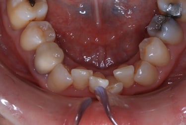 pictures of teeth