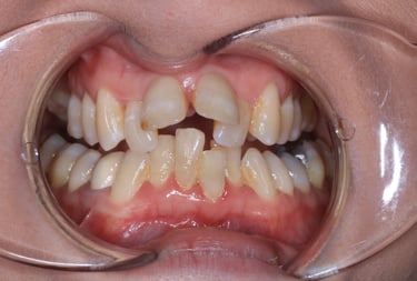 pictures of teeth
