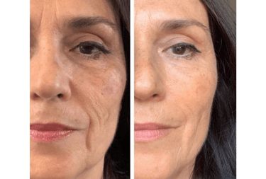 Elixir da Beleza 01- Skinbooster