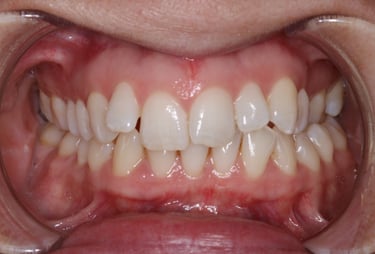 pictures of teeth