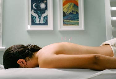 Patient receiving professional acupuncture therapy with needles in back for holistic pain relief.