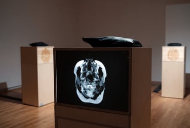 Une IRM du cerveau sur une boîte lumineuse avec un coussin vibrant à ondes cérébrales.