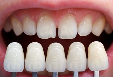 fatete dentare protetica coroane punte lucrare proteza