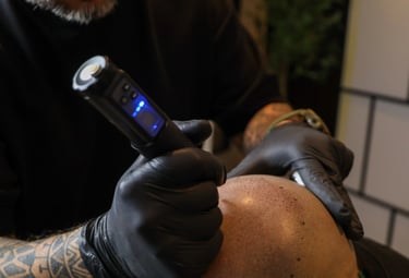 séance de micropigmentation capillaire sur un homme ayant perdu ses cheveux