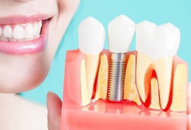 Smiling woman with tooth implant model