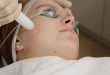 cabinet perma médical : laser Fotona