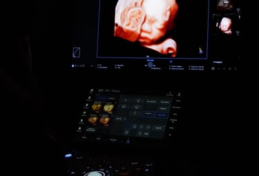 Sala de ultrassom premium com aparelho Samsung Hera Z20 na clínica Eema Indaiatuba.