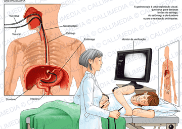 Imagen Endoscopia utilizado en la pagina web de la Dra. Arlenis Guzmán 
