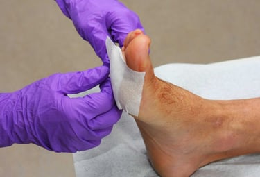 CURACION DE HERIDAS