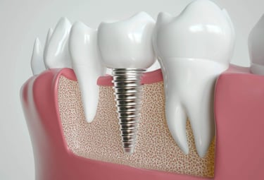 Cosmedic Express clinics in Turkey/Albania perform Dental Implants and Cosmetic Dentistry