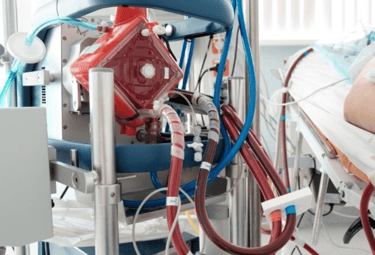 ECMO