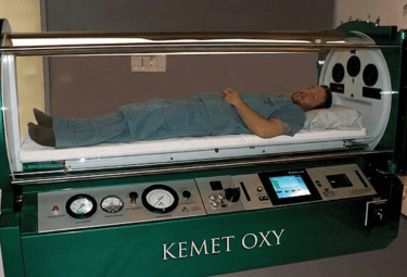 A patient lies inside a Kemet Oxy monoplace hyperbaric oxygen therapy chamber for medical treatment.