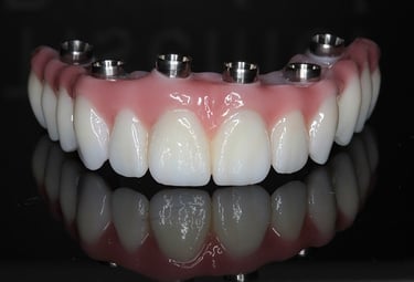 Protesis sobre implantes en Santo Domingo