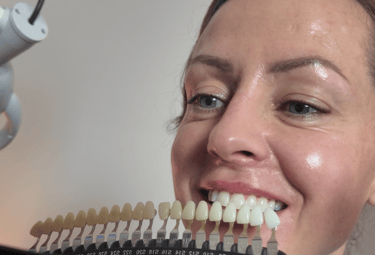 GloSmilz teeth whitening analysis