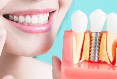 Smiling Woman and dental model with dental implant