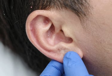 Close-up of a gentle laser auriculotherapy session focusing on the ear with soft green and terracotta tones.