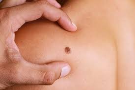 Tratamento_Dermatologico_Centro_Medico_Vida