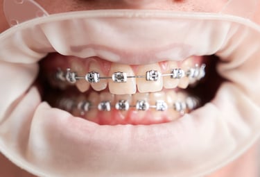 a man with braces and braces on his teeth