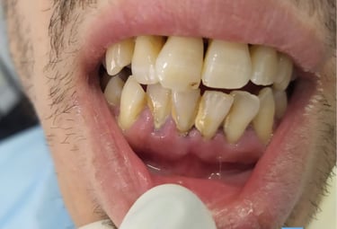 periodoncia badajoz