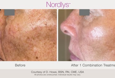 professional skin assessment for acne pigmentation and redness concerns in Hamilton Ontario