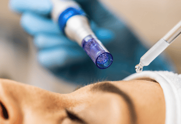 Dermapen, limpieza facial profunda