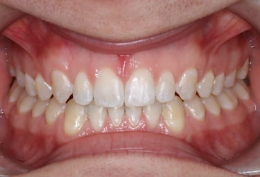 pictures of teeth