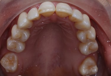pictures of teeth