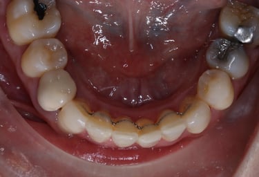 pictures of teeth