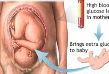 gestational diabetes