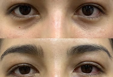 Orbit & Oculoplasty