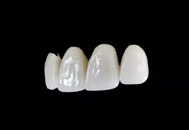 veneers crowns bridges bondings